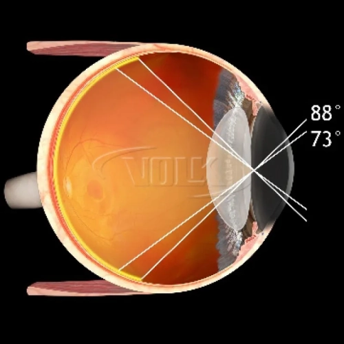 Central Retina