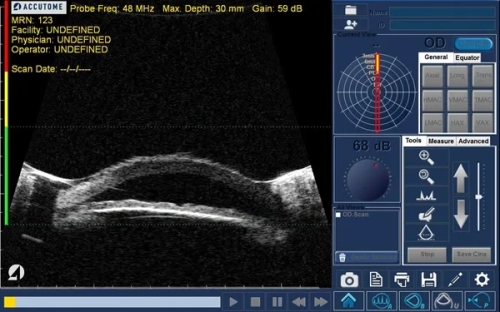 Пристрій ультразвукової діагностики 4Sight