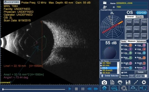 Пристрій ультразвукової діагностики 4Sight