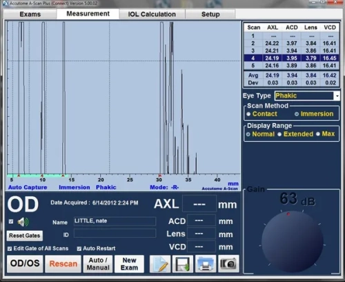 Ультразвуковий сканер A-Scan Plus Connect