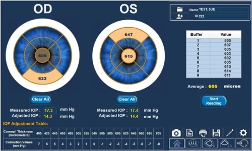 Пристрій ультразвукової діагностики 4Sight