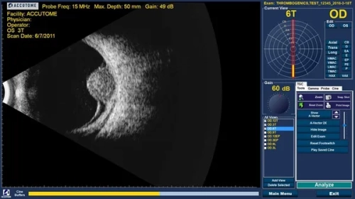 Ультразвуковий датчик В-Scan Plus