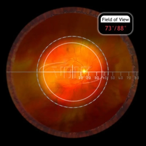Central Retina