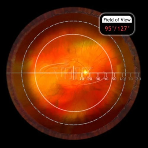 DynaView 156