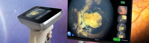 Педіатрична система PanoCam PRO